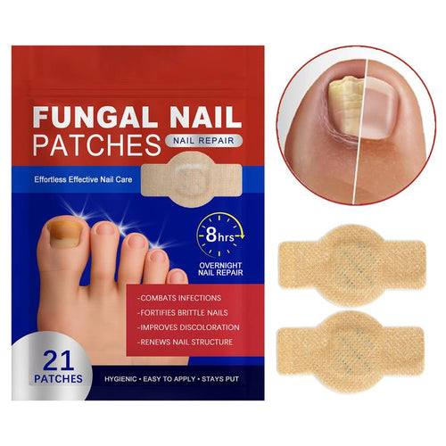 Eliminate Toenail Fungus Overnight While You Sleep