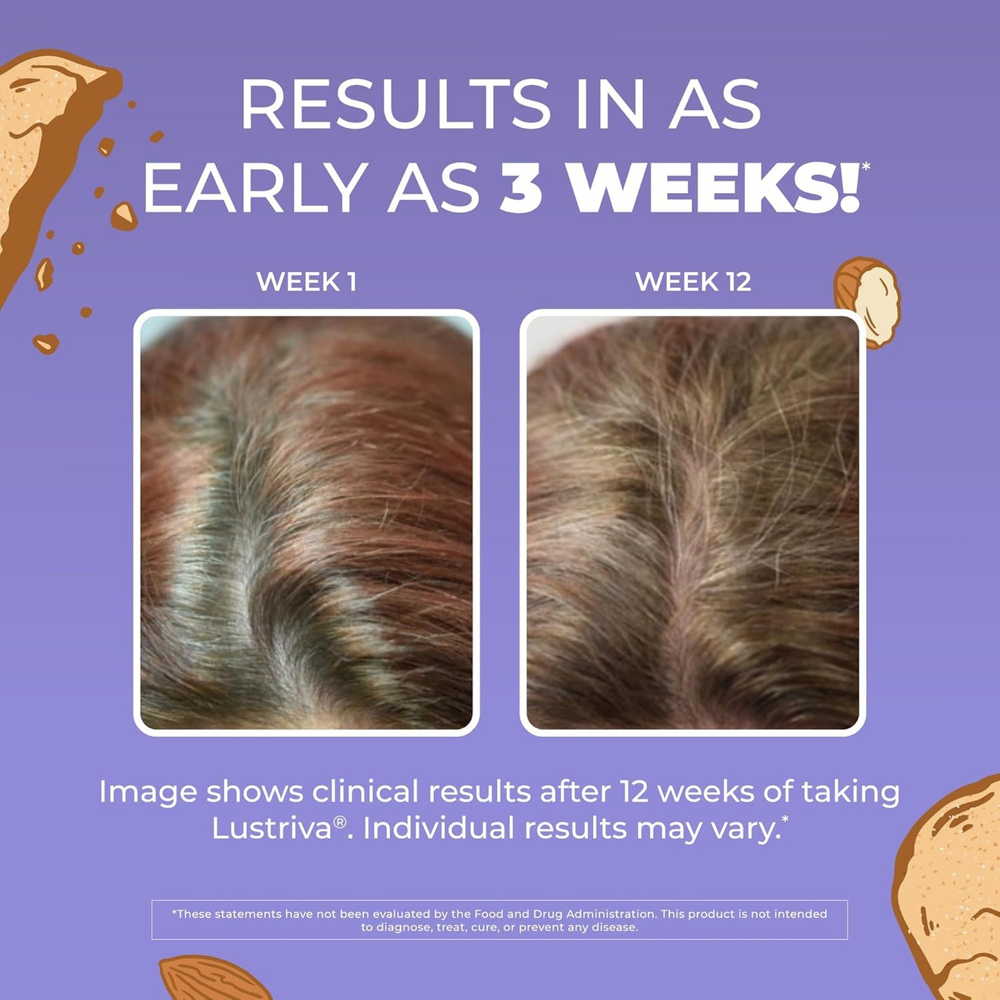 Liposomal Hair Growth Supplement - Clinically Tested Lustriva For Thicker-Looking Hair