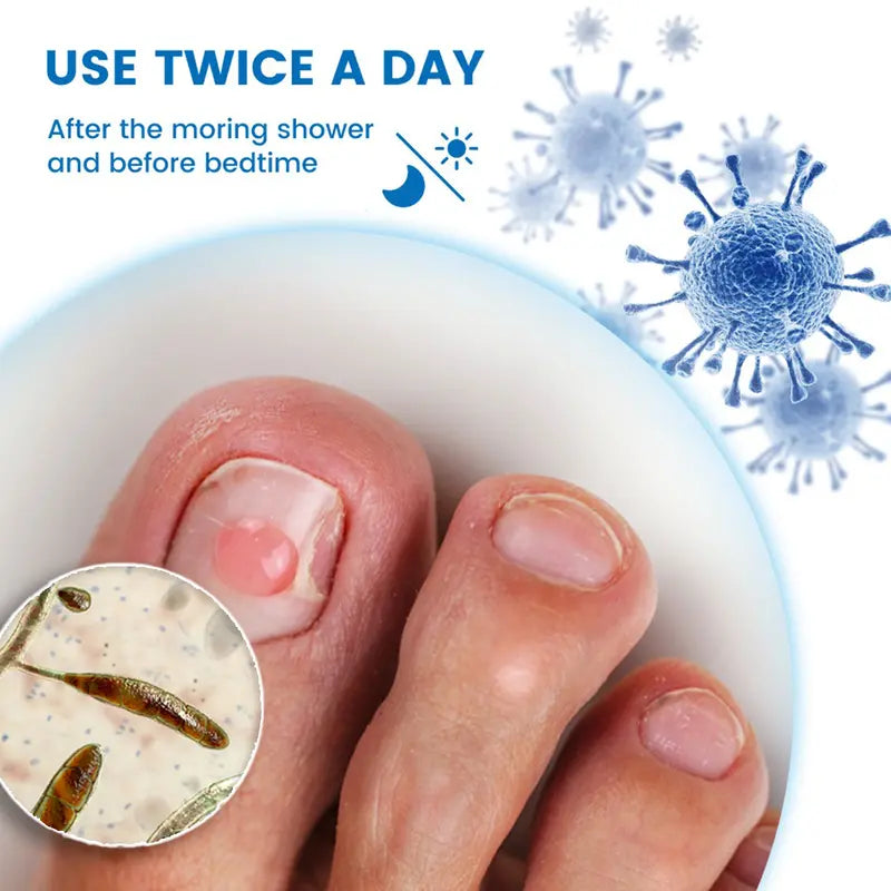Get Clear, Healthy Nails in Just 7 Days – 100% Plant-Based Extra Strength Liquid