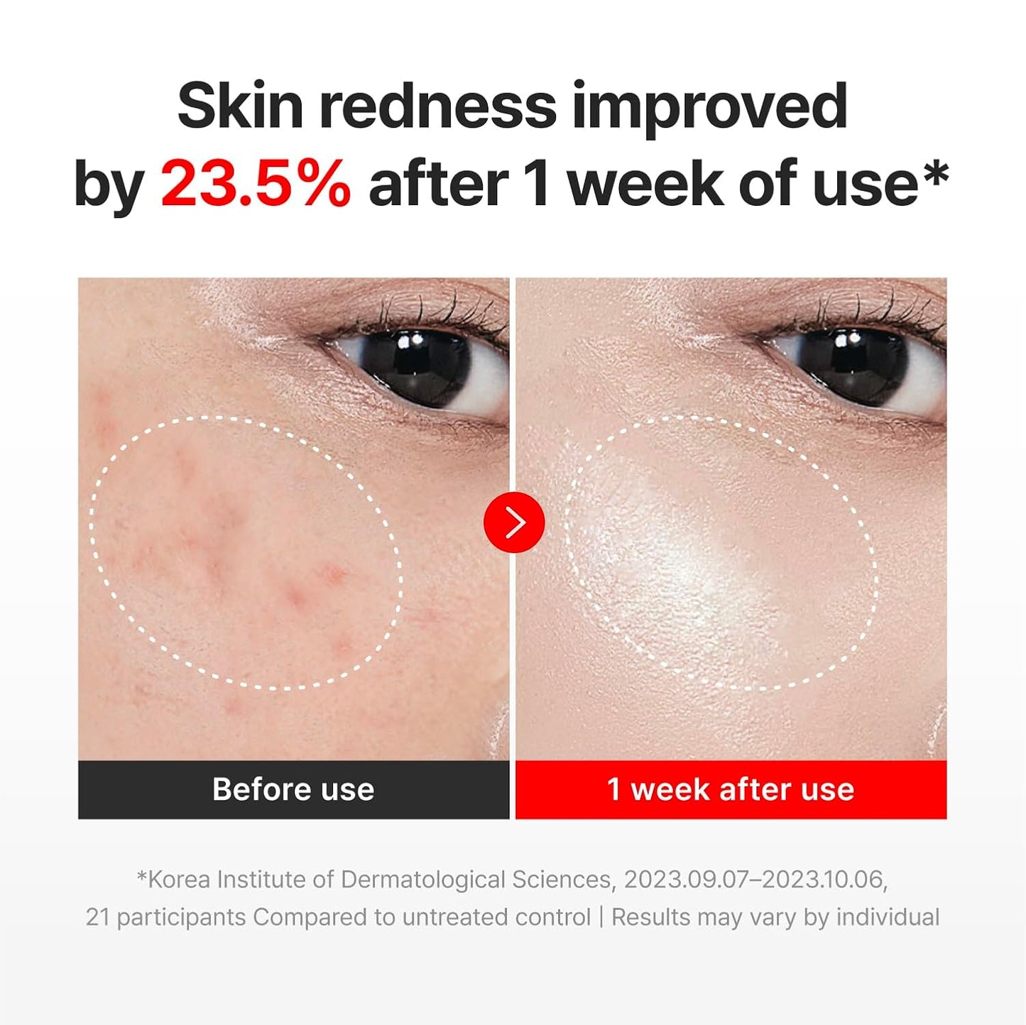 Anti-Aging Face Cream - Cica + Hyaluronic Acid Care For Wrinkles & Dry Skin