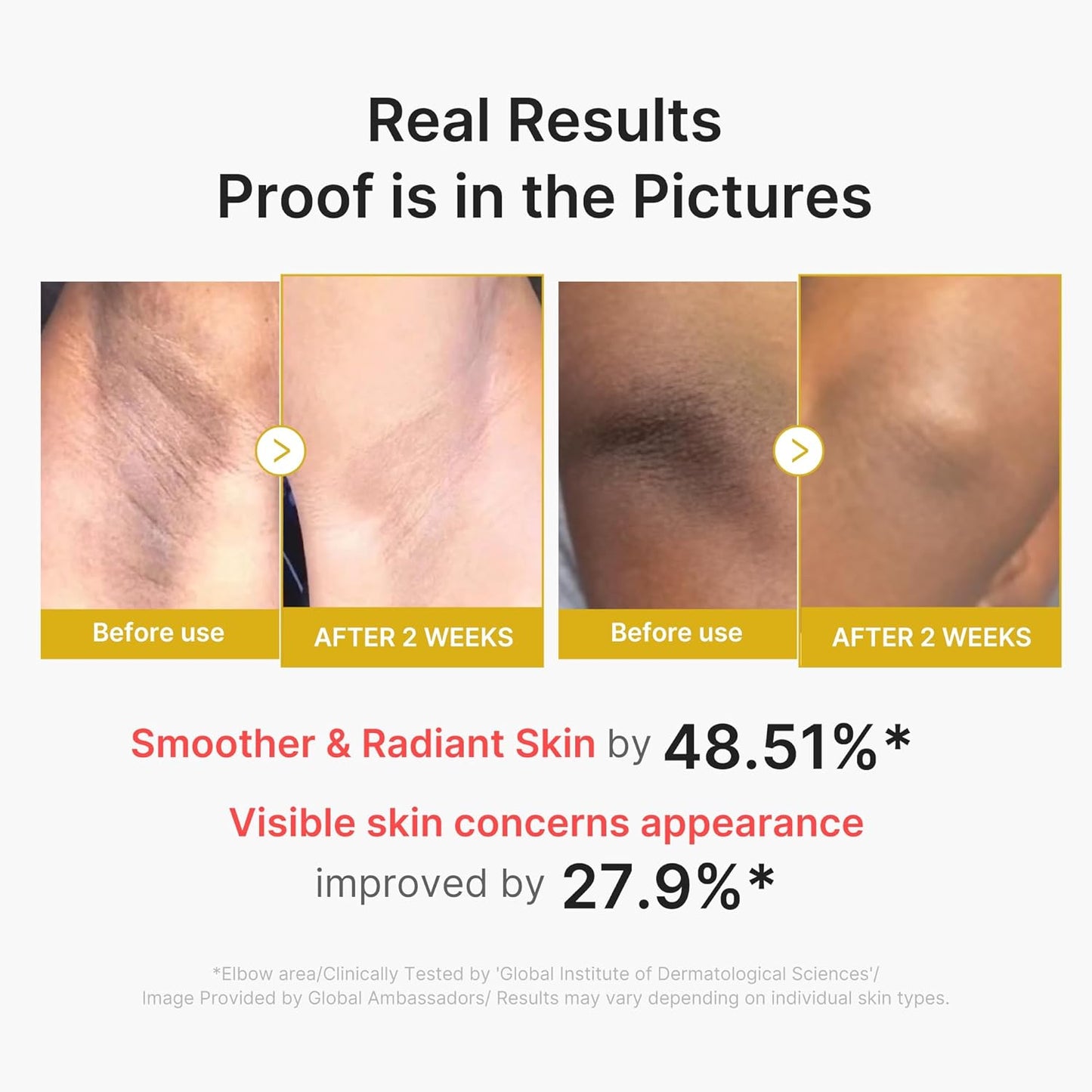 Peel Shot Duo - Kojic Acid & Turmeric Multi-Acid Resurfacing System For Bright, Smooth Skin