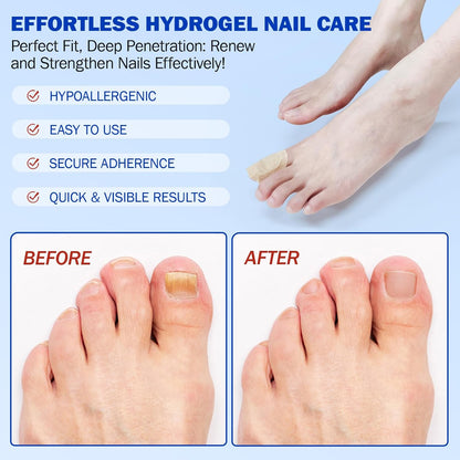 Eliminate Toenail Fungus Overnight While You Sleep