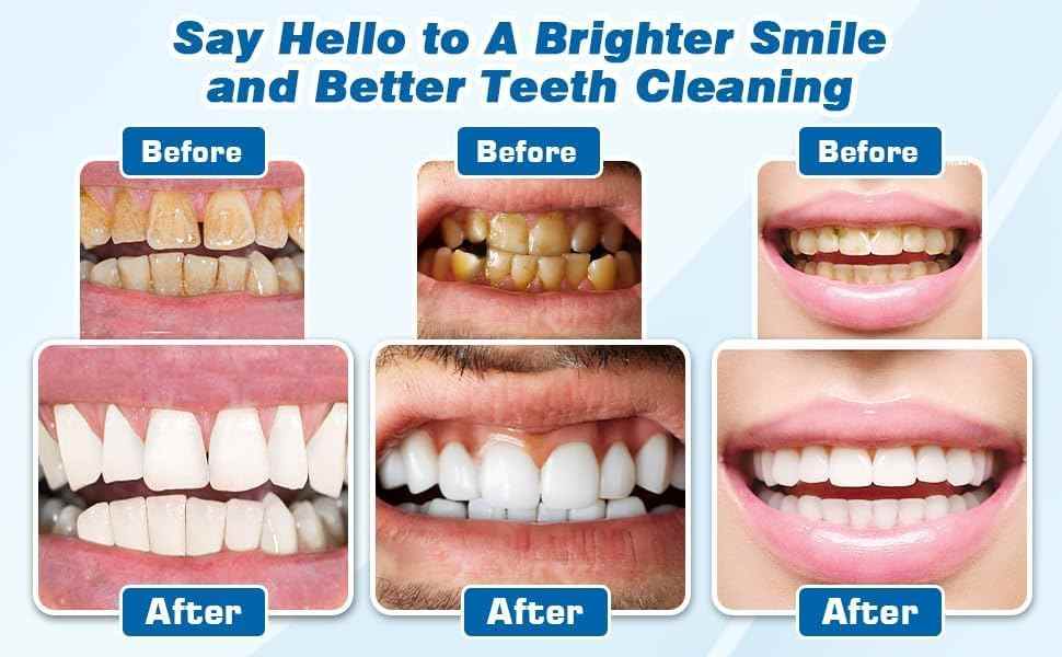 Blast Away Stubborn Tartar Instantly With This Sonic Dental Calculus Remover & Toothbrush Combo