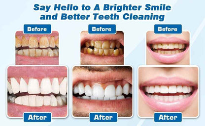 Blast Away Stubborn Tartar Instantly With This Sonic Dental Calculus Remover & Toothbrush Combo