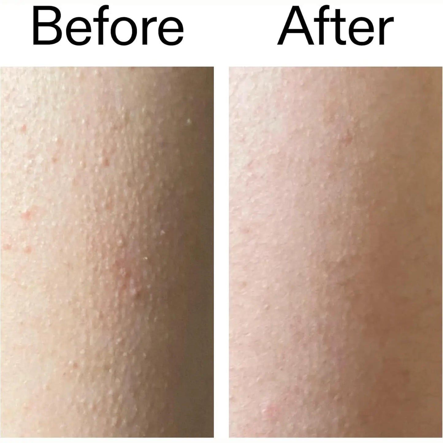 Exfoliating Body Stick – 7% AHA/BHA Formula For Smoother-Looking Skin Texture