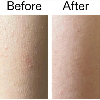 Exfoliating Body Stick – 7% AHA/BHA Formula For Smoother-Looking Skin Texture